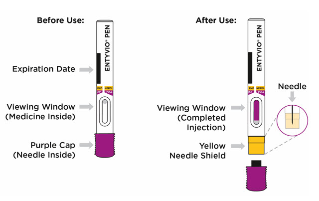 ENTYVIO- vedolizumab injection, powder, lyophilized, for ...